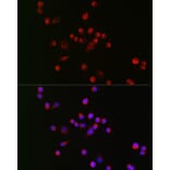 Immunofluorescence - Anti-Nav1.8 / SCN10A Antibody (A309017) - Antibodies.com