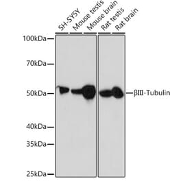Western Blot - Anti-beta III Tubulin Antibody [ARC0456] (A309019) - Antibodies.com