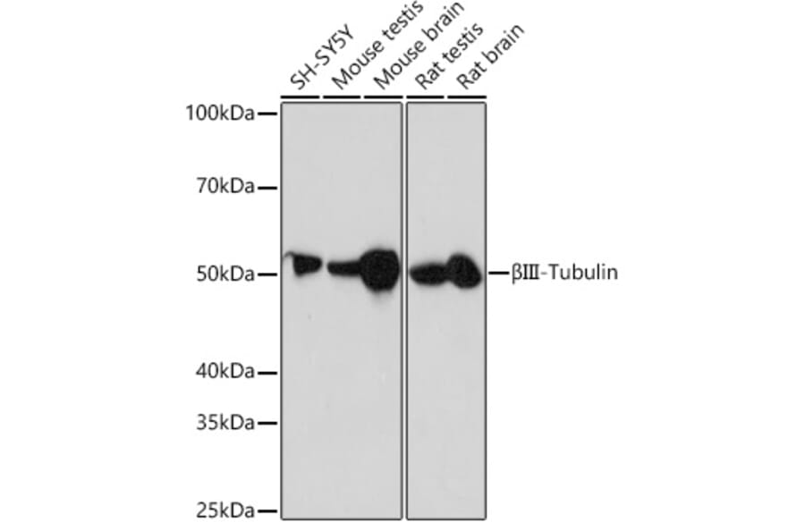 Western Blot - Anti-beta III Tubulin Antibody [ARC0456] (A309019) - Antibodies.com