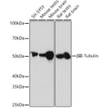 Western Blot - Anti-beta III Tubulin Antibody [ARC0456] (A309019) - Antibodies.com