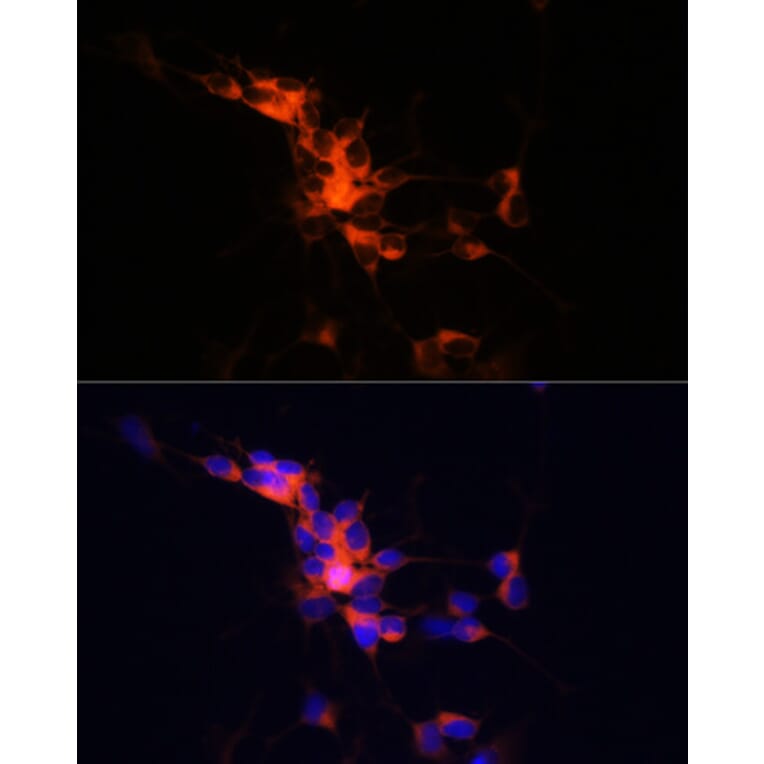 Immunofluorescence - Anti-beta III Tubulin Antibody [ARC0456] (A309019) - Antibodies.com