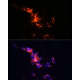 Immunofluorescence - Anti-beta III Tubulin Antibody [ARC0456] (A309019) - Antibodies.com