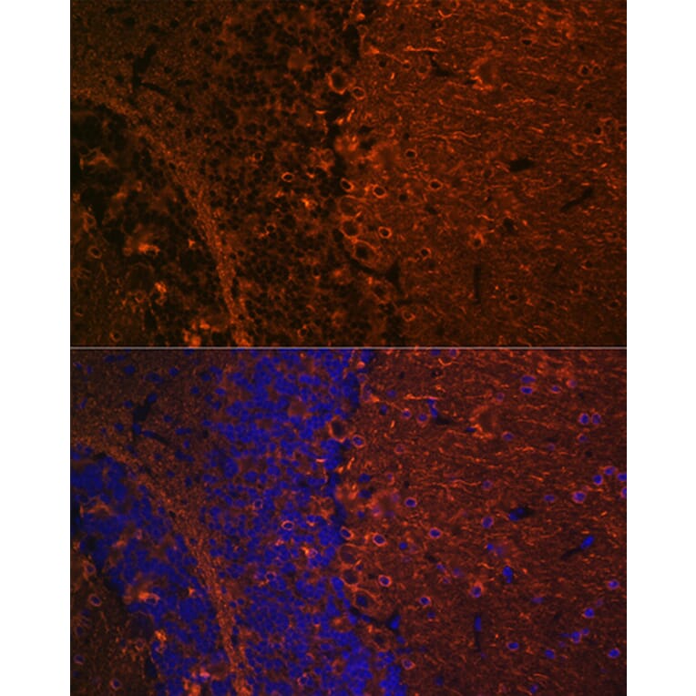 Immunofluorescence - Anti-beta III Tubulin Antibody [ARC0456] (A309019) - Antibodies.com