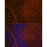 Immunofluorescence - Anti-beta III Tubulin Antibody [ARC0456] (A309019) - Antibodies.com