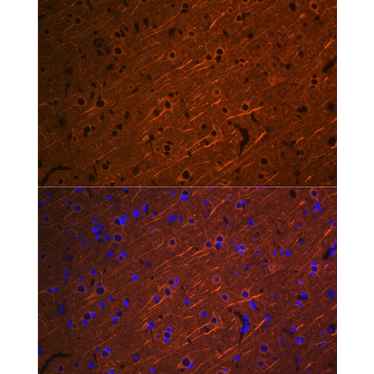 Immunofluorescence - Anti-beta III Tubulin Antibody [ARC0456] (A309019) - Antibodies.com