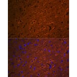 Immunofluorescence - Anti-beta III Tubulin Antibody [ARC0456] (A309019) - Antibodies.com
