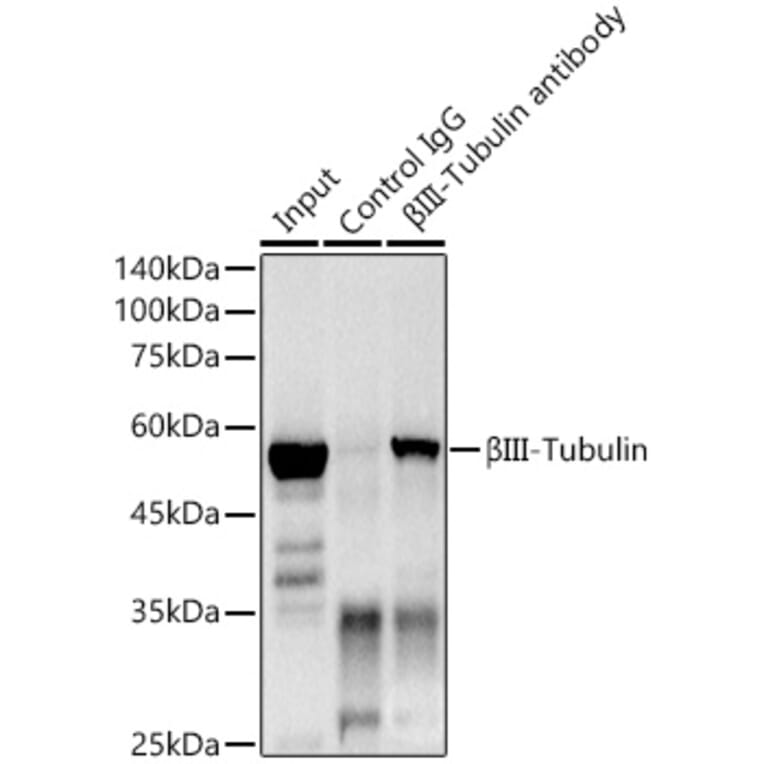 Western Blot - Anti-beta III Tubulin Antibody [ARC0456] (A309019) - Antibodies.com