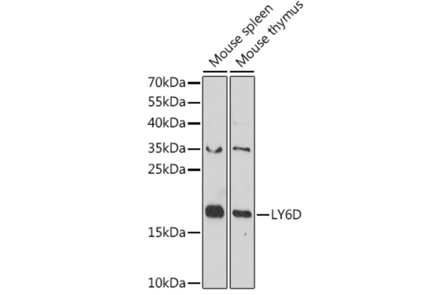 Western Blot - Anti-ThB Antibody (A309020) - Antibodies.com