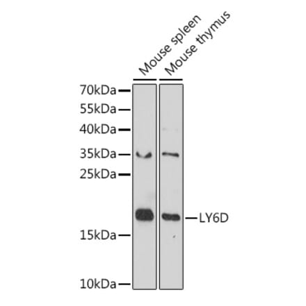 Western Blot - Anti-ThB Antibody (A309020) - Antibodies.com