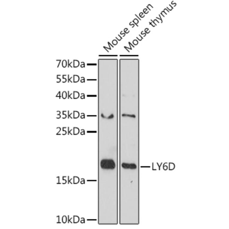 Western Blot - Anti-ThB Antibody (A309020) - Antibodies.com