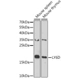 Western Blot - Anti-ThB Antibody (A309020) - Antibodies.com