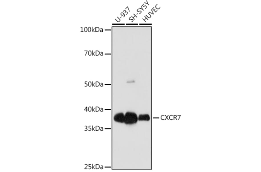 Western Blot - Anti-GPCR RDC1/CXCR-7 Antibody [ARC1374] (A309021) - Antibodies.com