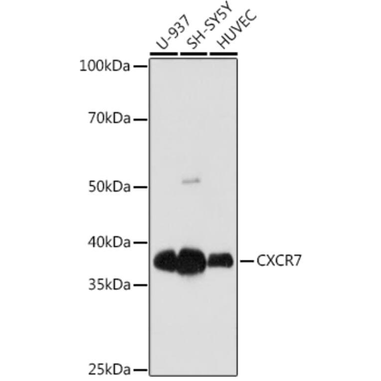 Western Blot - Anti-GPCR RDC1/CXCR-7 Antibody [ARC1374] (A309021) - Antibodies.com