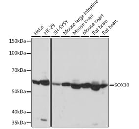 Western Blot - Anti-SOX10 Antibody [ARC1767] (A309022) - Antibodies.com
