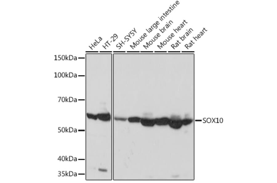Western Blot - Anti-SOX10 Antibody [ARC1767] (A309022) - Antibodies.com