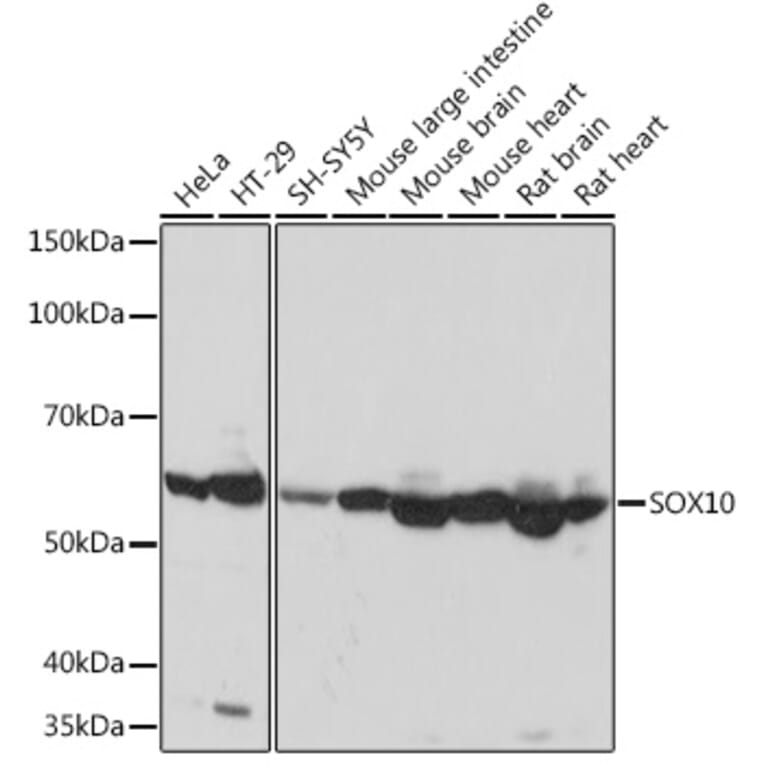 Western Blot - Anti-SOX10 Antibody [ARC1767] (A309022) - Antibodies.com