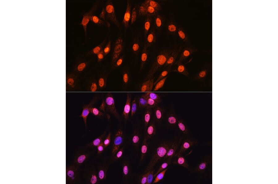 Immunofluorescence - Anti-SOX10 Antibody [ARC1767] (A309022) - Antibodies.com