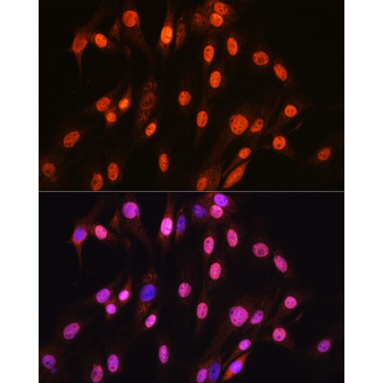 Immunofluorescence - Anti-SOX10 Antibody [ARC1767] (A309022) - Antibodies.com