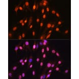 Immunofluorescence - Anti-SOX10 Antibody [ARC1767] (A309022) - Antibodies.com