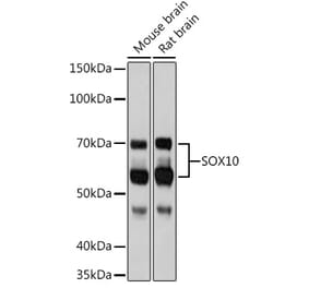 Western Blot - Anti-SOX10 Antibody [ARC1768] (A309023) - Antibodies.com