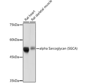 Western Blot - Anti-alpha Sarcoglycan Antibody [ARC2280] (A309024) - Antibodies.com