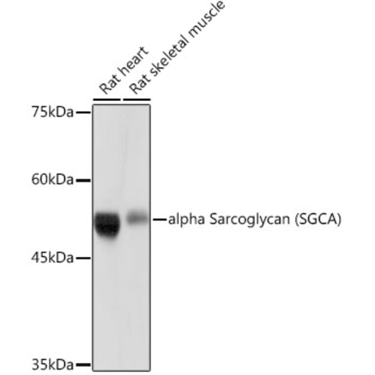 Western Blot - Anti-alpha Sarcoglycan Antibody [ARC2280] (A309024) - Antibodies.com