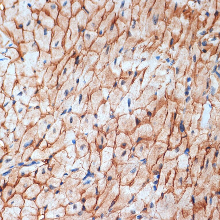 Immunohistochemistry - Anti-alpha Sarcoglycan Antibody [ARC2280] (A309024) - Antibodies.com