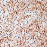 Immunohistochemistry - Anti-alpha Sarcoglycan Antibody [ARC2280] (A309024) - Antibodies.com