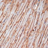 Immunohistochemistry - Anti-alpha Sarcoglycan Antibody [ARC2280] (A309024) - Antibodies.com