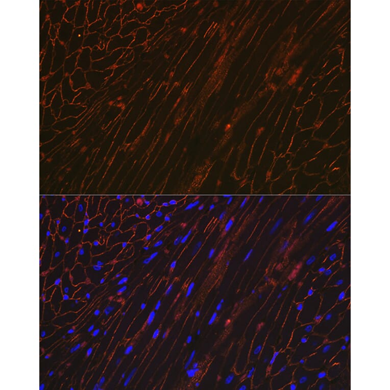 Immunofluorescence - Anti-alpha Sarcoglycan Antibody [ARC2280] (A309024) - Antibodies.com