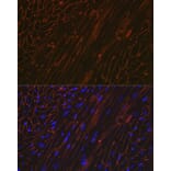 Immunofluorescence - Anti-alpha Sarcoglycan Antibody [ARC2280] (A309024) - Antibodies.com