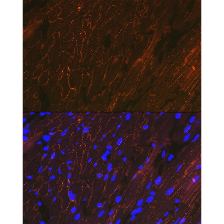 Immunofluorescence - Anti-alpha Sarcoglycan Antibody [ARC2280] (A309024) - Antibodies.com