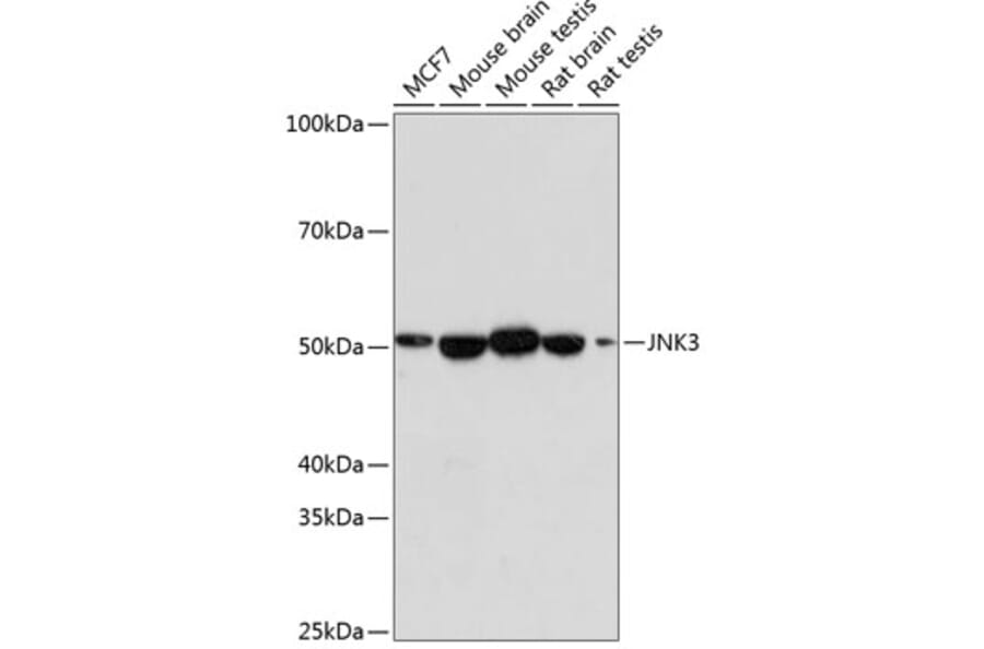 Western Blot - Anti-JNK3 Antibody [ARC0366] (A309026) - Antibodies.com