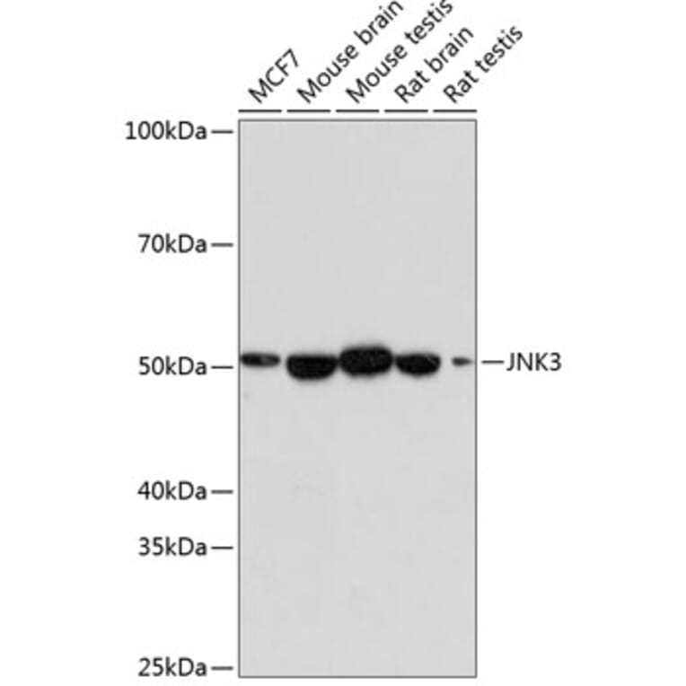 Western Blot - Anti-JNK3 Antibody [ARC0366] (A309026) - Antibodies.com