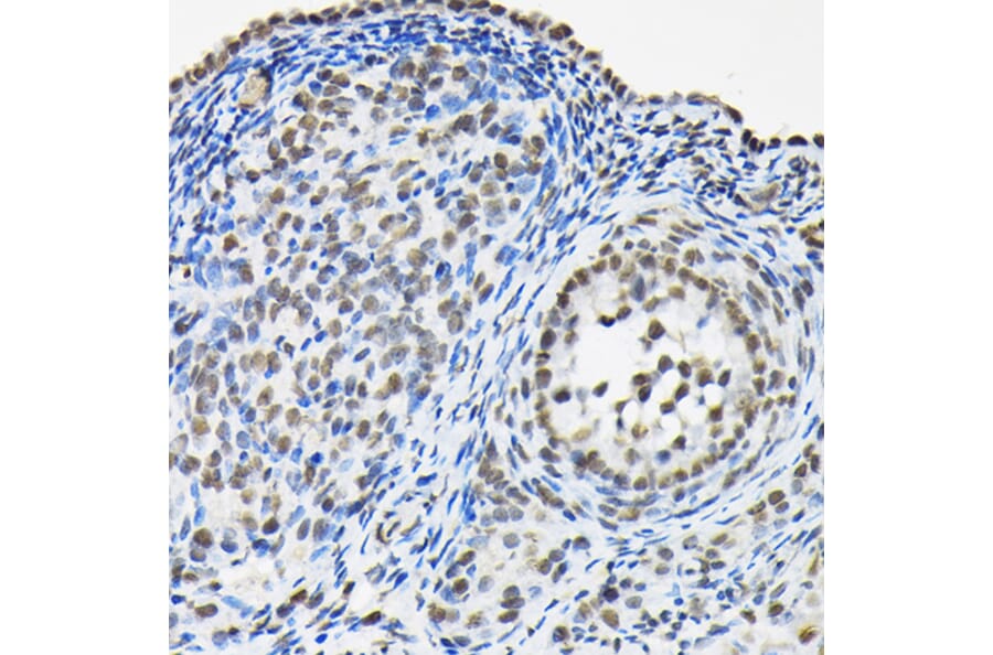 Immunohistochemistry - Anti-HNRNPA3 Antibody (A309027) - Antibodies.com