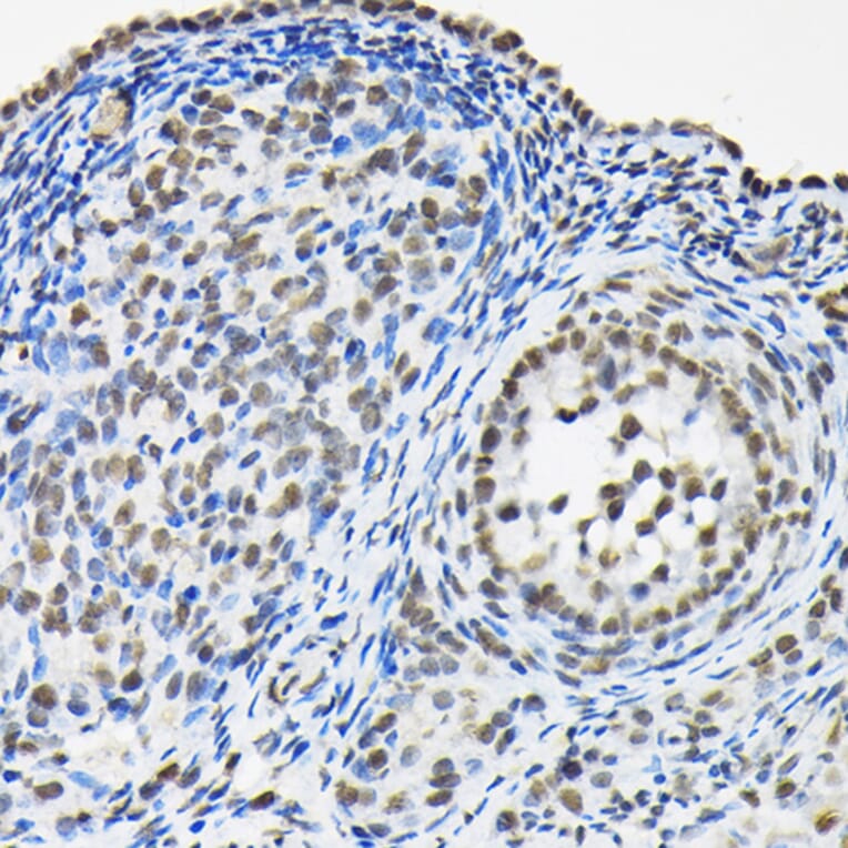 Immunohistochemistry - Anti-HNRNPA3 Antibody (A309027) - Antibodies.com