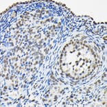 Immunohistochemistry - Anti-HNRNPA3 Antibody (A309027) - Antibodies.com