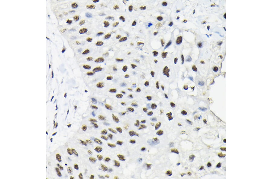Immunohistochemistry - Anti-HNRNPA3 Antibody (A309027) - Antibodies.com