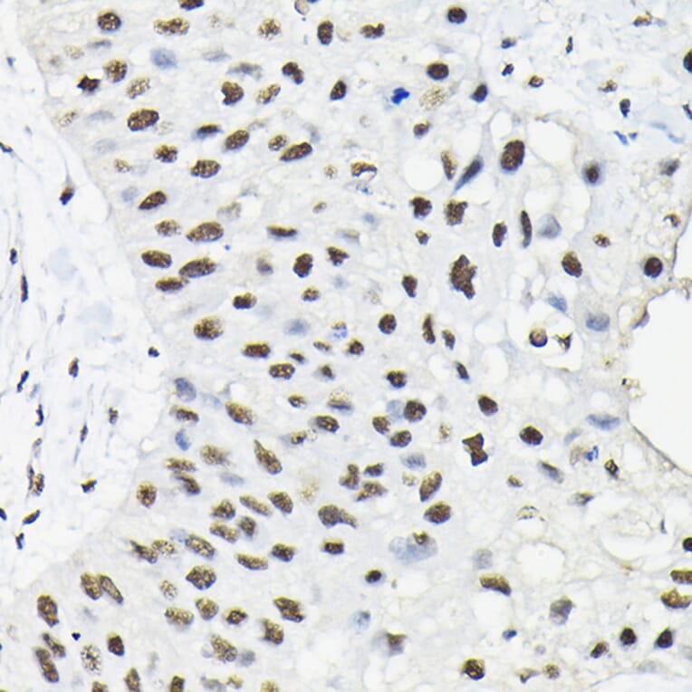Immunohistochemistry - Anti-HNRNPA3 Antibody (A309027) - Antibodies.com