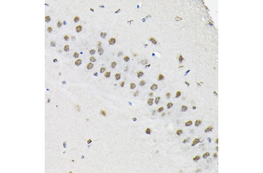 Immunohistochemistry - Anti-HNRNPA3 Antibody (A309027) - Antibodies.com