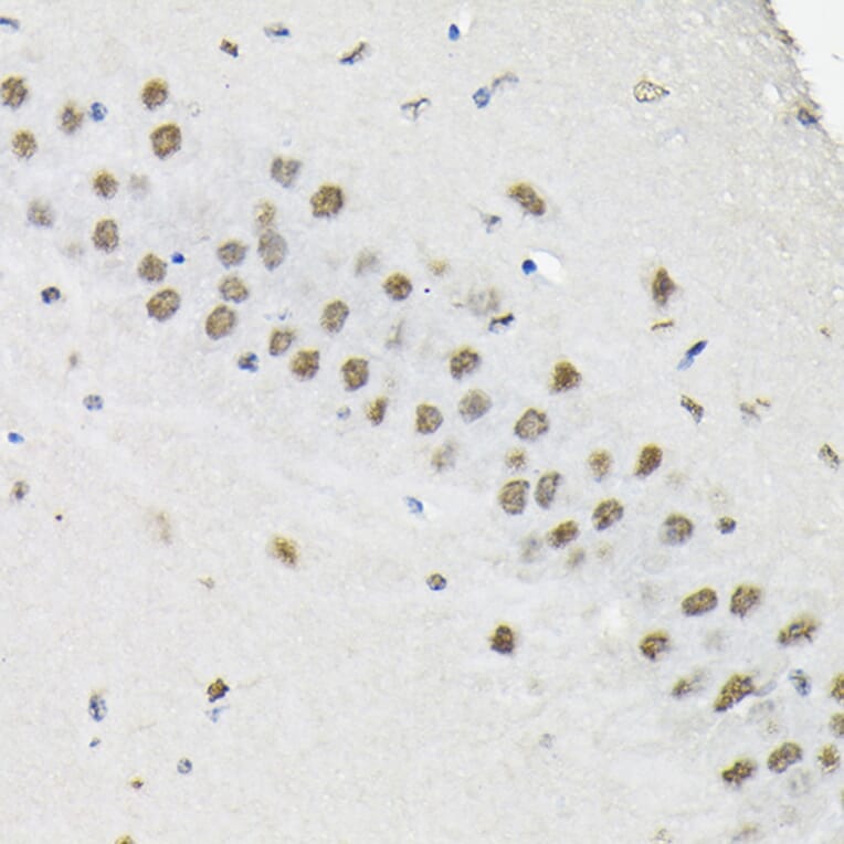 Immunohistochemistry - Anti-HNRNPA3 Antibody (A309027) - Antibodies.com