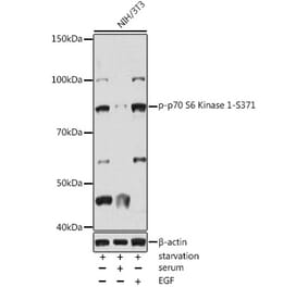 Western Blot - Anti-S6K1 (phospho Ser371) Antibody (A309030) - Antibodies.com