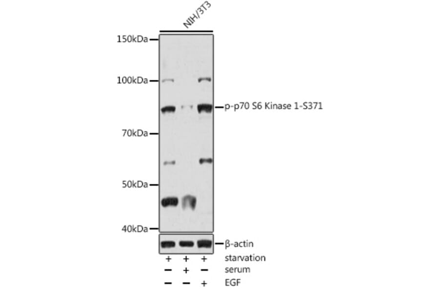 Western Blot - Anti-S6K1 (phospho Ser371) Antibody (A309030) - Antibodies.com
