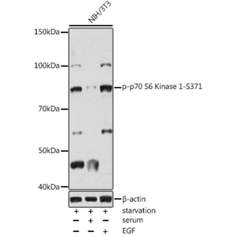 Western Blot - Anti-S6K1 (phospho Ser371) Antibody (A309030) - Antibodies.com