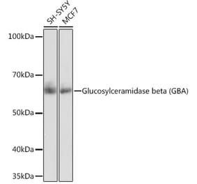 Western Blot - Anti-GBA Antibody [ARC0500] (A309031) - Antibodies.com