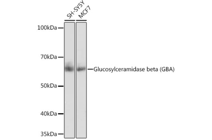Western Blot - Anti-GBA Antibody [ARC0500] (A309031) - Antibodies.com