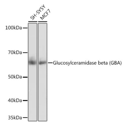 Western Blot - Anti-GBA Antibody [ARC0500] (A309031) - Antibodies.com
