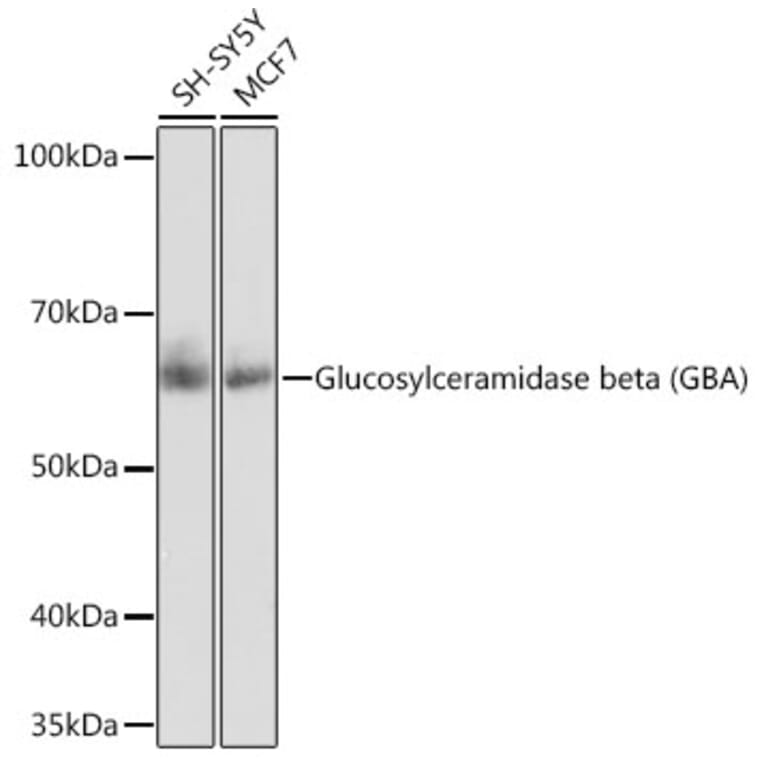 Western Blot - Anti-GBA Antibody [ARC0500] (A309031) - Antibodies.com
