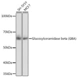 Western Blot - Anti-GBA Antibody [ARC0500] (A309031) - Antibodies.com