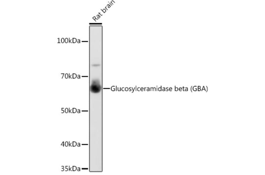 Western Blot - Anti-GBA Antibody [ARC0500] (A309031) - Antibodies.com